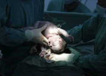 Anne karnındaki bebeğe beyin ameliyatı