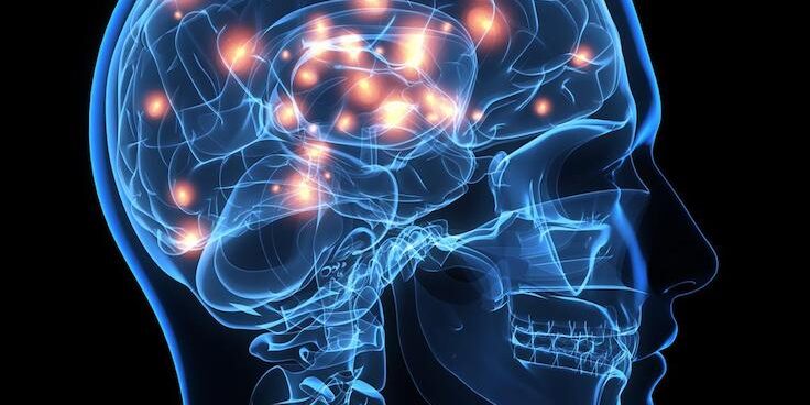 Felce beyin implantı çaresi 1 Felce beyin implantı çaresi