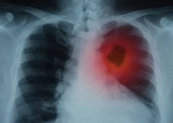 Yapay zeka kanseri tespit edebiliyor