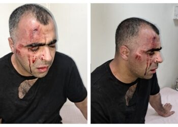 AK Parti’li Tatvan Belediye Başkanı’nın korumaları gazeteciyi dövdü