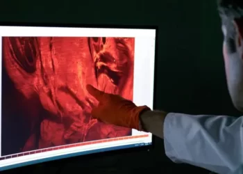 Türk profesörün “şeffaf görüntüleme” teknolojisi kanser tedavisinde yeni bir dönemi başlattı