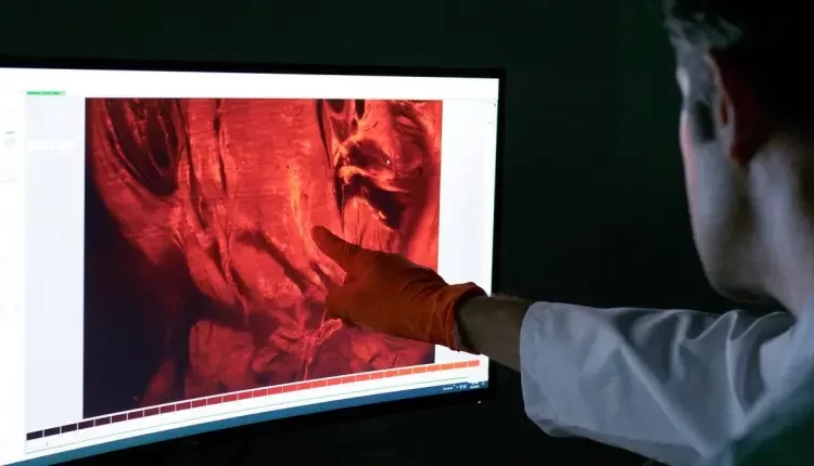 Türk profesörün “şeffaf görüntüleme” teknolojisi kanser tedavisinde yeni bir dönemi başlattı