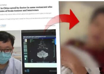 Yemek yediği restoranda görünüşüne bakıp teşhis koydu: Beyninizde tümör olabilir