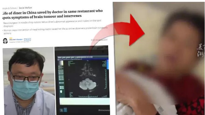 Yemek yediği restoranda görünüşüne bakıp teşhis koydu: Beyninizde tümör olabilir 1 Yemek yediği restoranda görünüşüne bakıp teşhis koydu: Beyninizde tümör olabilir