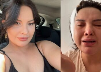 Estetik faciası; badem göz ameliyatı hayatını kararttı