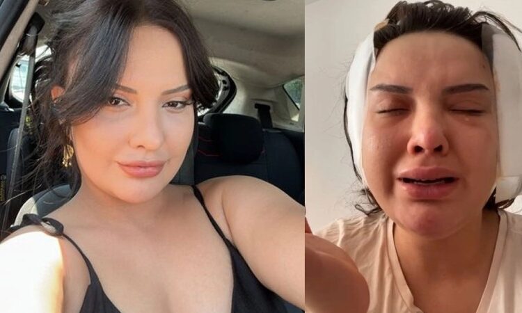 Estetik faciası; badem göz ameliyatı hayatını kararttı