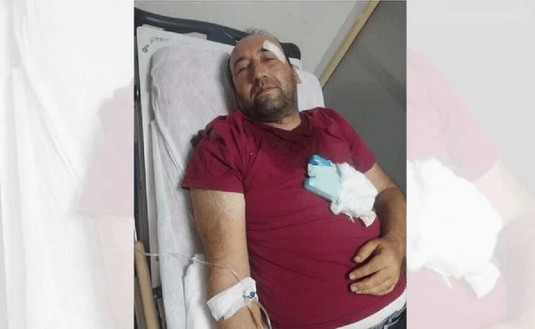 Viranşehir’de belediye başkanının korumasından gazeteciye darp ve tehdit: Belediyeyle ilgili yazarsan ölürsün