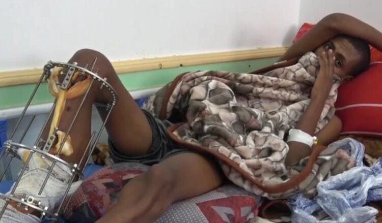 Suudi Arabistan, Yemen sınırında yüzlerce göçmeni öldürmekle suçlanıyor