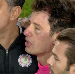 Ankaragücü Başkanı Koca'dan hakem Meler'e sahada yumruklu saldırı 2 Ankaragücü Başkanı Koca'dan hakem Meler'e sahada yumruklu saldırı