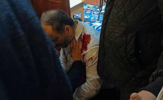 إمام مسجد الفاتح باسطنبول يتعرض للطعن بسكين 1 إمام مسجد الفاتح باسطنبول يتعرض للطعن بسكين