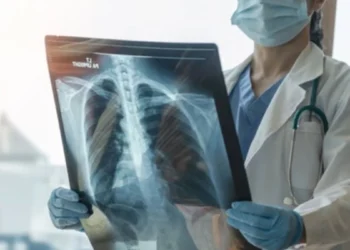 Korkutan rakam! Türkiye’de her yıl 41 bin kişi akciğer kanserine yakalanıyor