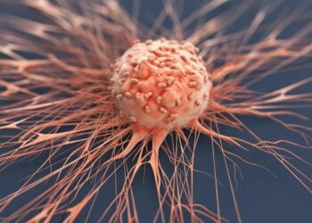 أطباء يحذرون من 23 عرضا نتجاهلها لكنها تنبأ عن الإصابة بالسرطان