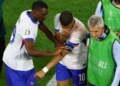 أمم أوروبا: بعد فوزها الافتتاحي على النمسا.. مبابي يصاب بكسر في أنفه