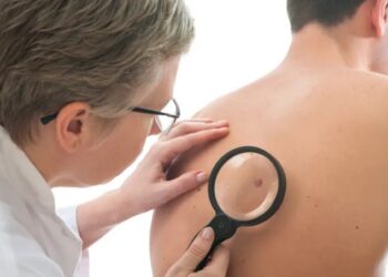 عكس المعتقد.. خطر الإصابة بسرطان الجلد الوراثي أعلى بمقدار 7 أضعاف