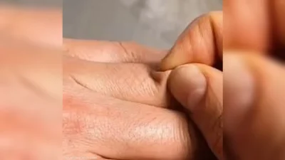 هل تشرب ما يكفيك من الماء؟ اختبار بسيط على الجلد يجيبك.. 2 هل تشرب ما يكفيك من الماء؟ اختبار بسيط على الجلد يجيبك..