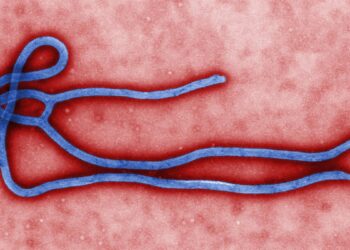 Colorized electron microscope image of an Ebola virus particle