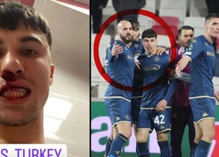 Sivasspor taraftarı Fiorentinalı oyuncunun burnunu kırdı 1 Sivasspor taraftarı Fiorentinalı oyuncunun burnunu kırdı