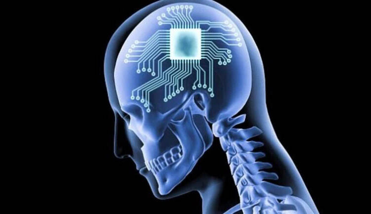 FDA’dan Musk’a izin çıktı: İnsan beynine çip takacak