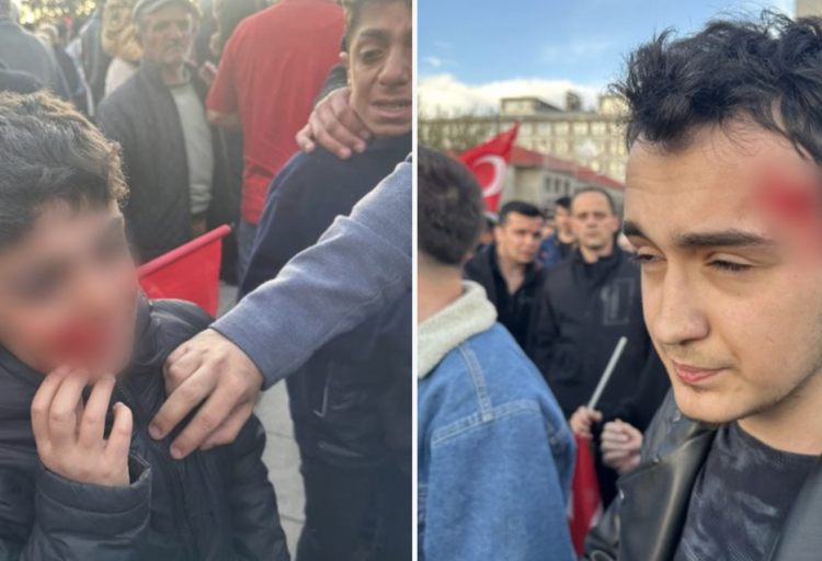 İmamoğlu’nun mitingine saldırı: Çok sayıda kişi yaralandı