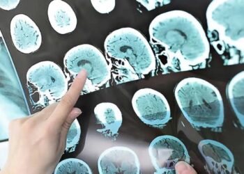 En ölümcül beyin kanserine çözüm bulundu