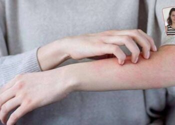 Uyuz alarmı: Krem ve losyonlar fayda etmiyor