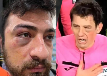 Tarık Gündoğan yazdı… Kaç doktor bir hakem eder?