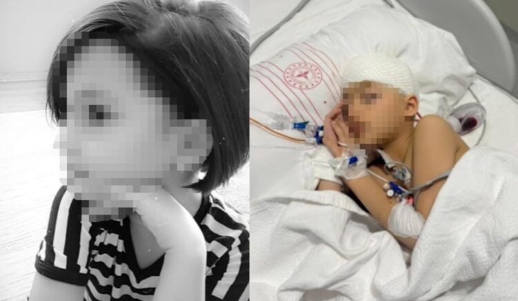 Okulda düştü denildi kafatasında 8 kırık çıktı! Beyin kanaması geçirdi durumu kritik