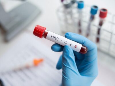Resmi rakamlar gerçeği yansıtmıyor! Türkiye'de AIDS vakaları artıyor 3 Resmi rakamlar gerçeği yansıtmıyor! Türkiye'de AIDS vakaları artıyor