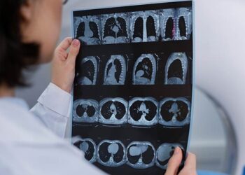 Bilim insanlarından çığır açacak keşif: Alzheimer riskini düşürecek gen bulundu!
