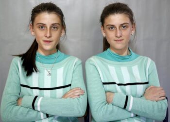 Tek yumurta ikizlerinin nasıl oluştuğu keşfedildi: Organ nakli ve tüp bebek tedavisi için umut olabilir