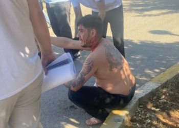 Dizi setine silahlı saldırı: Bir oyuncu yaralandı