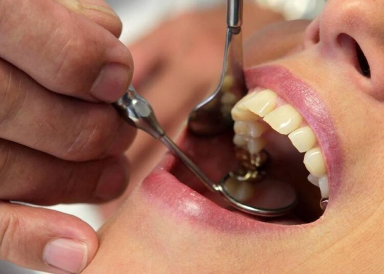 20'lik dişini çektiren kadına hepatit bulaştı 1 20’lik dişini çektiren kadına hepatit bulaştı