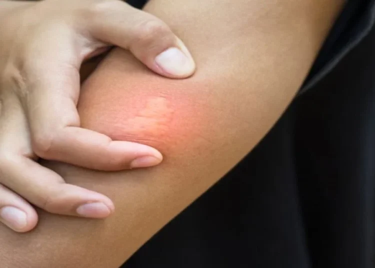 Şimdi de Batı Nil Virüsü çıktı; Türkiye’de 6 vaka görüldü