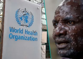 DSÖ, maymun çiçeği salgını nedeniyle ‘küresel acil durum’ ilan etti