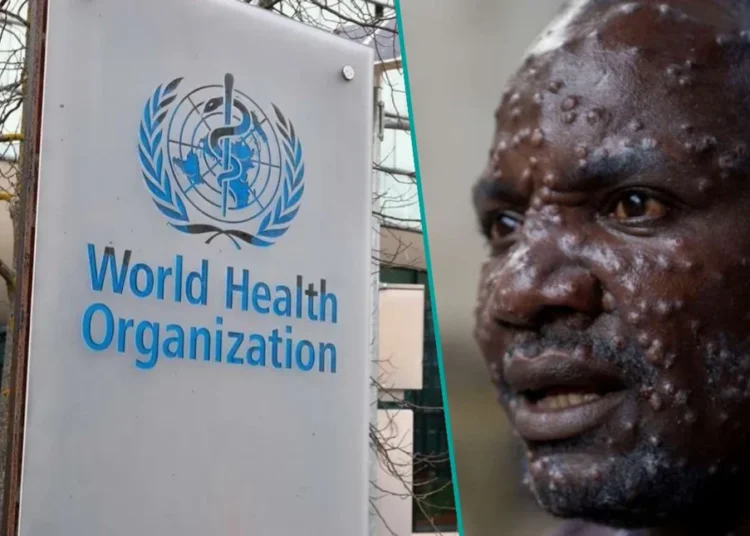 DSÖ, maymun çiçeği salgını nedeniyle 'küresel acil durum' ilan etti 1 DSÖ, maymun çiçeği salgını nedeniyle ‘küresel acil durum’ ilan etti