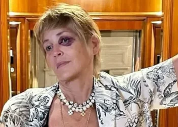 Sharon Stone, Bodrum’da otelde kaza geçirdi