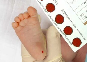 Mahkemenin ‘topuk kanı’ kararının referansı, alternatif tıp uzmanı