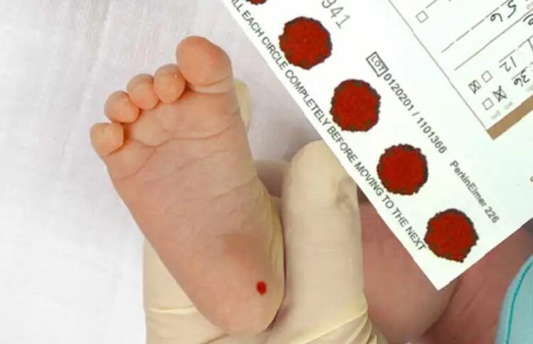 Mahkemenin ‘topuk kanı’ kararının referansı, alternatif tıp uzmanı