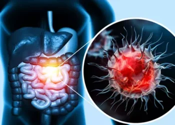 Bağırsak kanseri riskini azaltmak için yapmanız gereken 5 şey