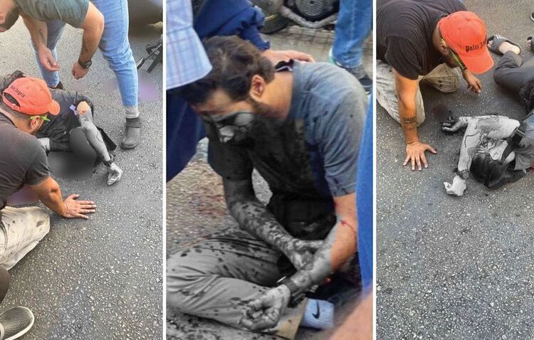 SON DAKİKA! Çağrı cihazlarının patlatıldığı olayda ölü sayısı 9 oldu 1 SON DAKİKA! Çağrı cihazlarının patlatıldığı olayda ölü sayısı 9 oldu