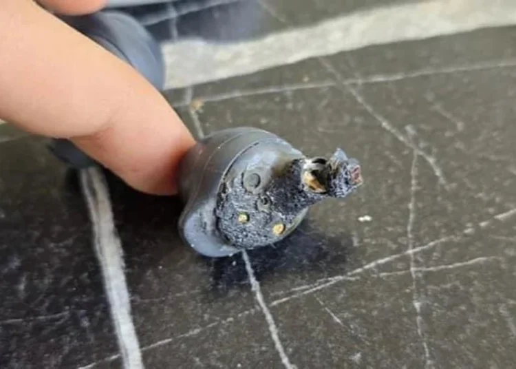 Samsung kulaklık kulağında patlayan genç artık duyamayacak