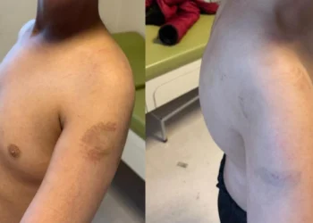 Beylikdüzü’nde bakım merkezinde skandal: Otizmli çocuklara şiddet uygulandı