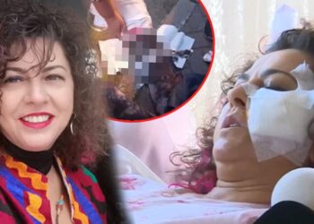 Köpeklerin saldırısına uğrayan akademisyen: Bu artık insan hakları sorunu