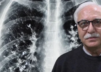 ‘Zatürre tanısında en önemli belirtiler nefes darlığı ve öksürük’