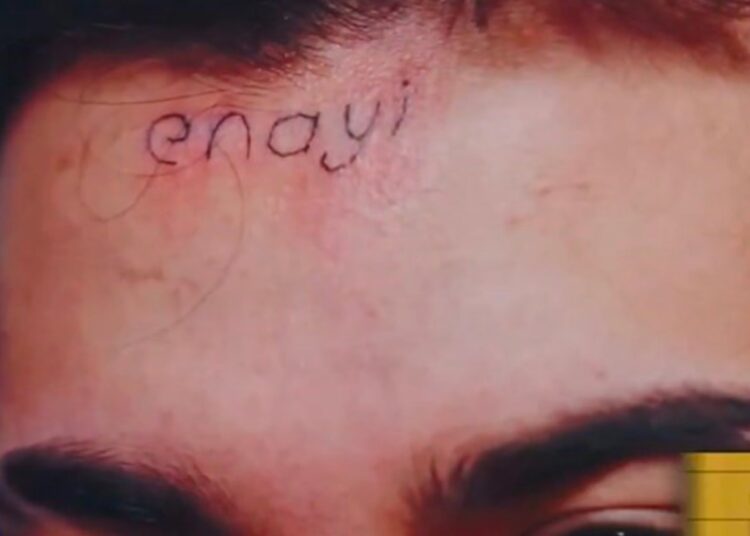 80 bin TL için alnına ‘enayi’ dövmesi yazdırdı