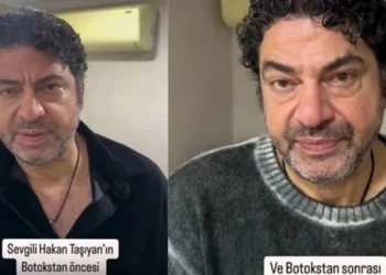 Ölümden dönen Hakan Taşıyan da estetik yaptıran ünlü erkekler arasına girdi