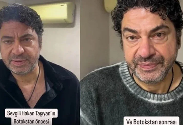 Ölümden dönen Hakan Taşıyan da estetik yaptıran ünlü erkekler arasına girdi 1 Ölümden dönen Hakan Taşıyan da estetik yaptıran ünlü erkekler arasına girdi