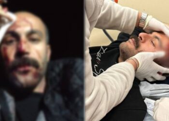 İddia: Polis, önce müvekkilini sonra avukatı darp etti