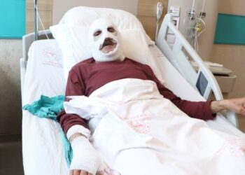 Gaz kaçağını çakmakla kontrol etti, hastanelik oldu