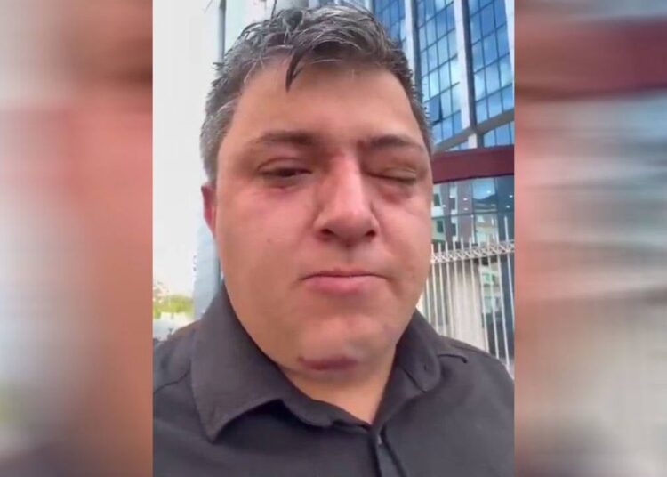 Altındağ Belediyesi’nde yine işçiye darp 1 Altındağ Belediyesi’nde yine işçiye darp